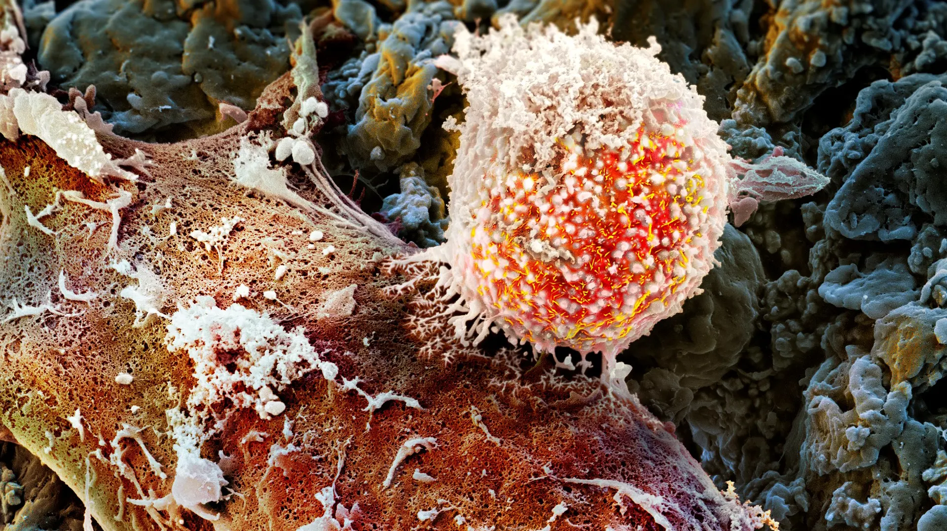 20251002 Bild Tumorzelle Mikroskop