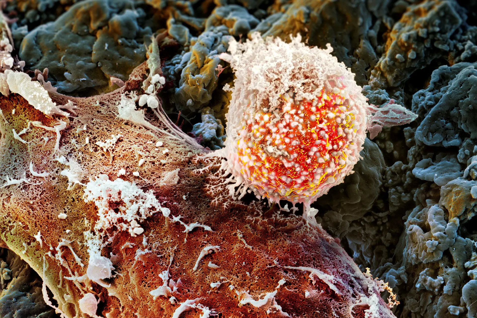 20251002 Bild Tumorzelle Mikroskop